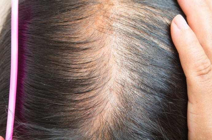 Early Signs of Hair Thinning